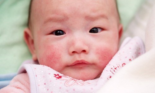 8 dấu hiệu nhắc mẹ cần phải thay sữa bột cho bé ngay
