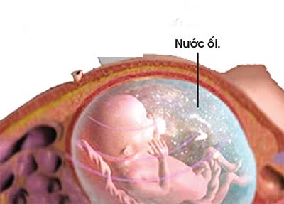nuoc-oi