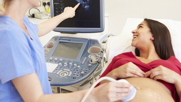  Kiểm tra CVS - 10 tuần tuổi