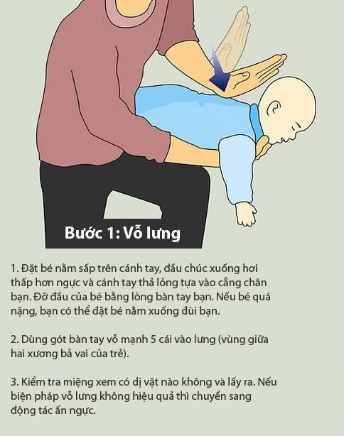 Cách sơ cứu chuẩn khi trẻ hóc dị vật